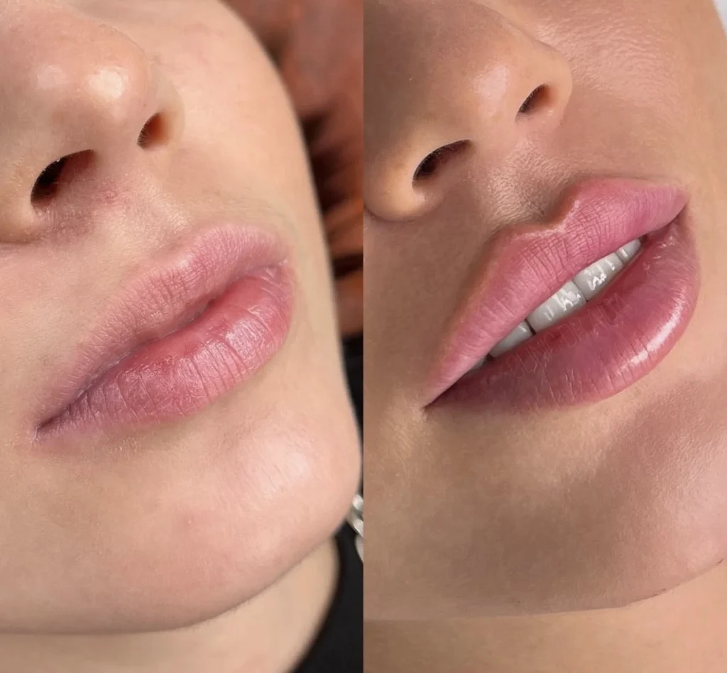 Russian Lips result 2