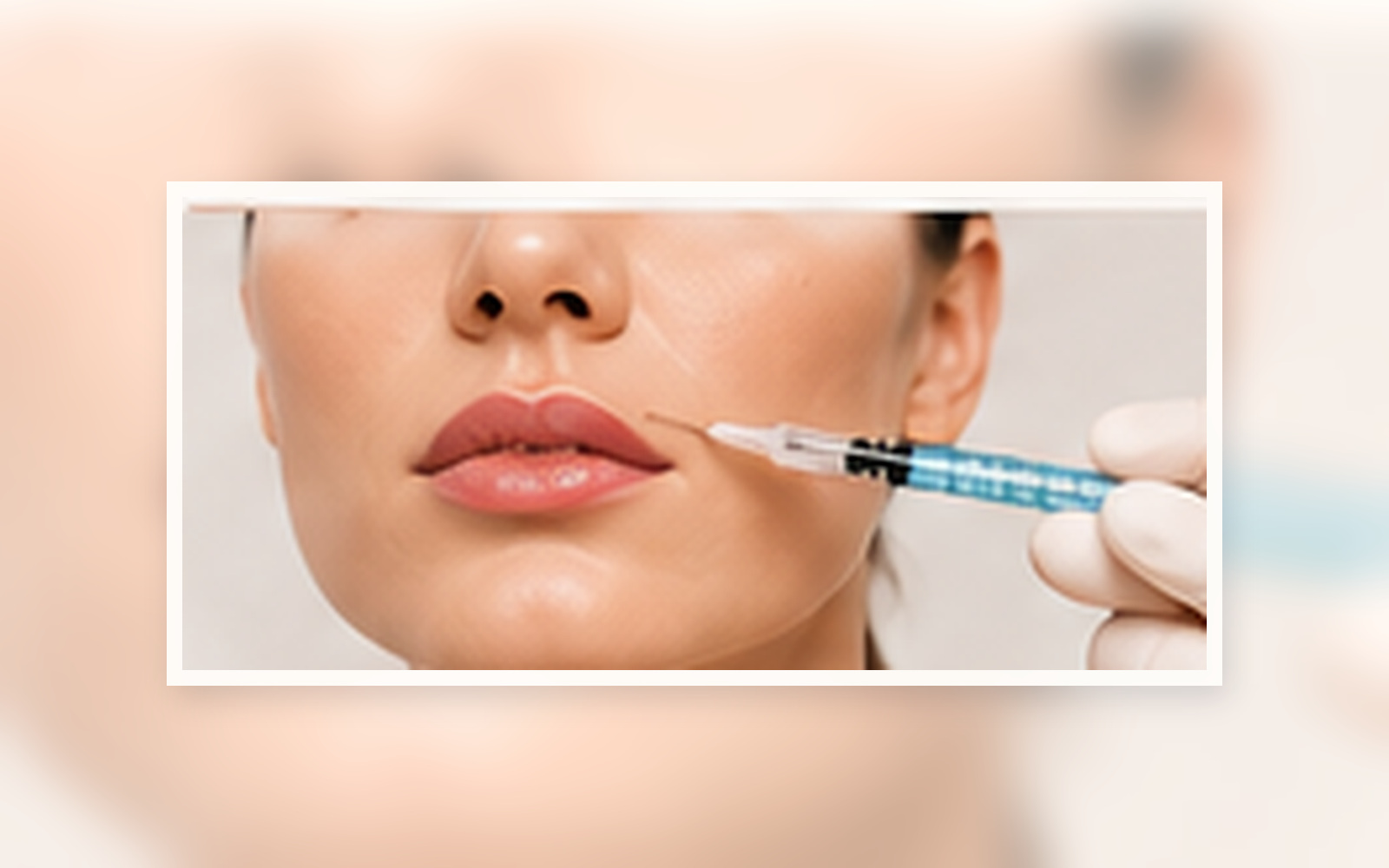 Injectable Wrinkle Fillers
